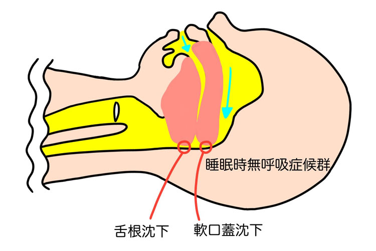 どうやって診断するの？